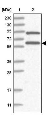 Western Blot: RNF25 Antibody [NBP2-32664] - Lane 1: Marker  [kDa] 230, 130, 95, 72, 56, 36, 28, 17, 11.  Lane 2: Human cell line RT-482