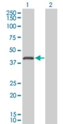 Western Blot: RNF26 Antibody (5B9) [H00079102-M01] - Analysis of RNF26 expression in transfected 293T cell line by RNF26 monoclonal antibody (M01), clone 5B9.Lane 1: RNF26 transfected lysate(47.737 KDa).Lane 2: Non-transfected lysate.