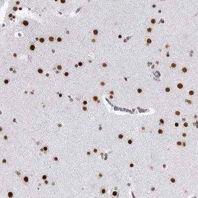 Immunohistochemistry-Paraffin RNF26 Antibody