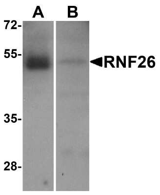 Western Blot: RNF26 Antibody [NBP2-81997] - Western blot analysis of RNF26 in (A) human tonsil and (B) rat stomach tissue lysate with RNF26 antibody at 1 ug/mL.