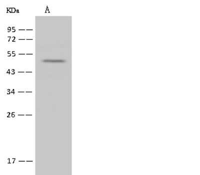 Western Blot: RNF26 Antibody [NBP2-97787] - Anti-RNF26 rabbit polyclonal antibody at 1:500 dilution. Lane A: 293T Whole Cell Lysate Lysates/proteins at 30 ug per lane. Secondary Goat Anti-Rabbit IgG (H+L)/HRP at 1/10000 dilution. Developed using the ECL technique. Performed under reducing conditions. Predicted band size: 48 kDa. Observed band size: 48 kDa