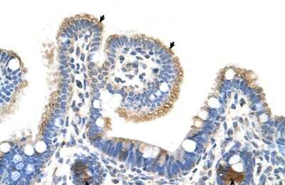 Immunohistochemistry-Paraffin: RNF39 Antibody [NBP1-55282] - Human Intestine Tissue, antibody concentration 4-8ug/ml. Cells with positive label: Epithelial cells of intestinal villus (indicated with arrows) 400X magnification.