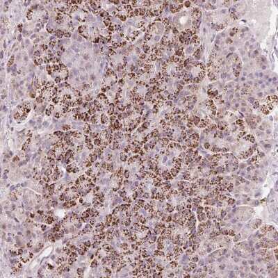 Immunohistochemistry-Paraffin: RNF39 Antibody [NBP2-33479] - Staining of human pancreas shows strong granular cytoplasmic positivity in exocrine glandular cells.
