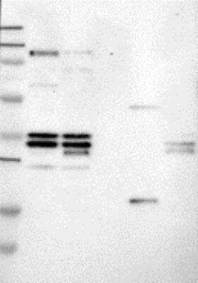 Western Blot: RNF39 Antibody [27510002] - Samples: Lane 1, Marker [kDa]: 250, 130, 95, 72, 55, 36, 28, 17, 11  Lane 2, RT-4  Lane 3, U-251MG sp  Lane 4, Human Plasma Lane 5, Liver  Lane 6, Tonsil ,  Target weight [kDa]: 46, 38 (splice variants)   Validation score:  2   Validation description: Supportive - Band of predicted size in kDa (+/-20%) with additional bands present.