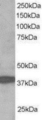 Western Blot: RNF39 Antibody [NB300-842] - (1ug/ml) of human brain lysate (RIPA buffer, 35ug total protein per lane). Primary incubated for 1 hour. Detected by western blot using chemiluminescence.