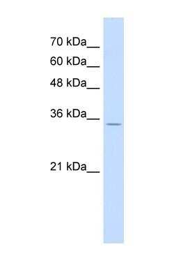 Western Blot RNF39 Antibody - BSA Free