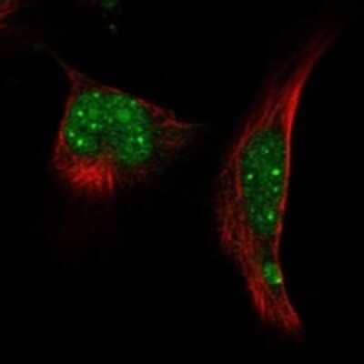 Immunocytochemistry/Immunofluorescence: RNF4 Antibody [NBP3-17431] - Staining of human cell line U-251 MG shows localization to nucleoplasm & nuclear bodies.