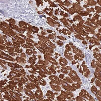 Immunohistochemistry-Paraffin RNF4 Antibody - BSA Free