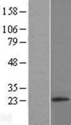 Western Blot: RNF4 Overexpression Lysate (Adult Normal) [NBP2-10244] Left-Empty vector transfected control cell lysate (HEK293 cell lysate); Right -Over-expression Lysate for RNF4.