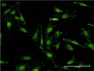 Immunocytochemistry/Immunofluorescence: RNF40 Antibody (1C1) [H00009810-M09] - Analysis of monoclonal antibody to RNF40 on HeLa cell. Antibody concentration 10 ug/ml