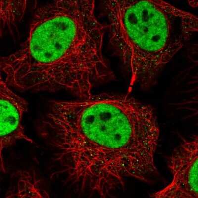 Immunocytochemistry/Immunofluorescence: RNF40 Antibody [NBP2-54968] - Staining of human cell line HeLa shows localization to nucleoplasm.