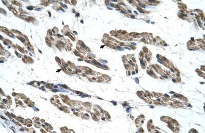 Immunohistochemistry: RNF40 Antibody [NBP1-53086] - Human Muscle