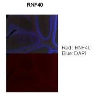 Immunohistochemistry: RNF40 Antibody [NBP1-53086] - SampleType : Adult mouse cerebellum (l0x) section Dilution : 1: 100 Secondary Antibody : Donkey Anti-rabbit (568 nm) Secondary Antibody Dilution : 1: 500 Color/Signal Descriptions : RNF40: Red DAPI: Blue Gene Name : RNF40 Submitted by : Anonymous