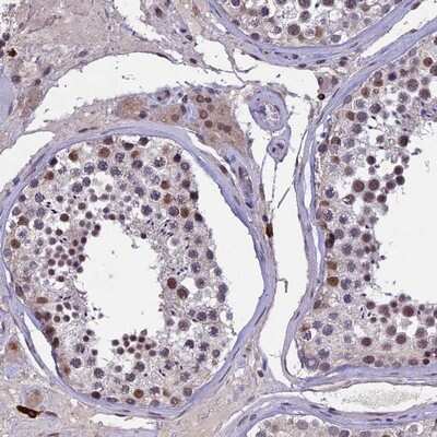 Immunohistochemistry-Paraffin: RNF40 Antibody [NBP1-88356] - Staining of human testis shows moderate nuclear positivity in cells in seminiferus ducts and Leydig cells.