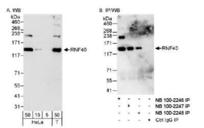 Western Blot: RNF40 Antibody [NB100-2247] - Detection of Human RNF40 on HeLa whole cell lysate using NB100-2247. RNF40 was also immunoprecipitated using rabbit anti-RNF40 antibodies NB100-2246 and NB100-2248.