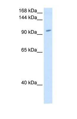 Western Blot: RNF40 Antibody [NBP1-53086] - Antibody Titration: 1.25ug/ml Positive Control: 293T cell lysate