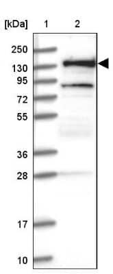 Western Blot: RNF40 Antibody [NBP1-88356] - Lane 1: Marker  [kDa] 250, 130, 95, 72, 55, 36, 28, 17, 10.  Lane 2: Human cell line RT-4