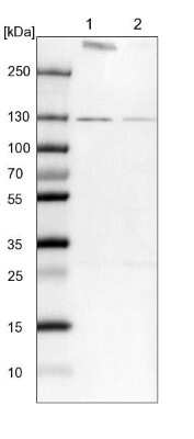 Western Blot: RNF40 Antibody [NBP1-88356] - Lane 1: NIH-3T3 cell lysate (Mouse embryonic fibroblast cells). Lane 2: NBT-II cell lysate (Rat Wistar bladder tumor cells).