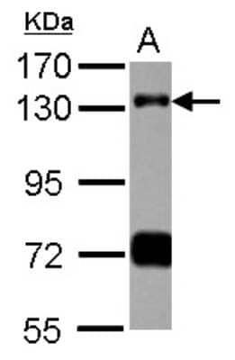 Western Blot: RNF40 Antibody [NBP2-20190] - Sample (30 ug of whole cell lysate) A: HeLa nucleus 7. 5% SDS PAGE gel, diluted at 1:1000.