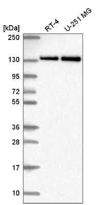 Western Blot: RNF40 Antibody [NBP2-54968] - Western blot analysis in human cell line RT-4 and human cell line U-251 MG.