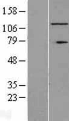 Western Blot: RNF40 Overexpression Lysate (Adult Normal) [NBL1-15455] Left-Empty vector transfected control cell lysate (HEK293 cell lysate); Right -Over-expression Lysate for RNF40.