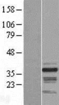 Western Blot RNF41 Overexpression Lysate