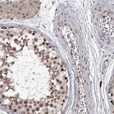 Immunohistochemistry-Paraffin: RNF44 Antibody [NBP1-82930] - Staining of human testis shows moderate nuclear positivity in cells in seminiferus ducts.