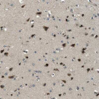 Immunohistochemistry-Paraffin: RNF70 Antibody [NBP1-87399] - Staining of human cerebral cortex shows high expression.