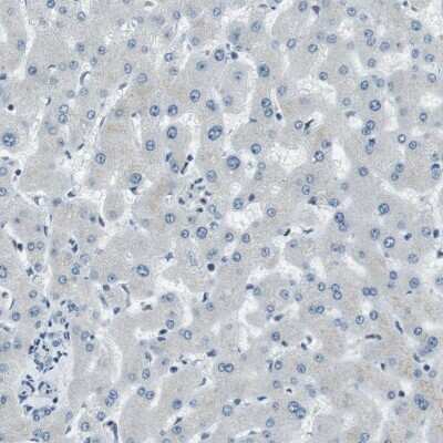 Immunohistochemistry-Paraffin: RNF70 Antibody [NBP1-87399] - Staining of human liver shows low expression as expected.