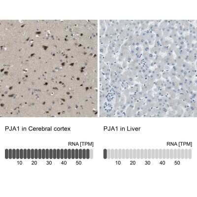 <b>Orthogonal Strategies Validation. </b>Immunohistochemistry-Paraffin: RNF70 Antibody [NBP1-87399] - Staining in human cerebral cortex and liver tissues using anti-PJA1 antibody. Corresponding PJA1 RNA-seq data are presented for the same tissues.