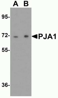 Western Blot: RNF70 Antibody [NBP2-81998] - Analysis of RNF70 in human brain tissue lysate with RNF70 antibody at (A) 0.25 and (B) 0.5 ug/ml.