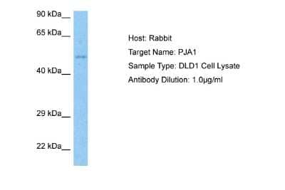 Western Blot: RNF70 Antibody [NBP2-85650] - Host: Rabbit. Target Name: PJA1. Sample Tissue: DLD1 Whole Cell lysates. Antibody Dilution: 1ug/ml