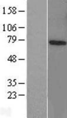 Western Blot: RNF70 Overexpression Lysate (Adult Normal) [NBL1-14453] Left-Empty vector transfected control cell lysate (HEK293 cell lysate); Right -Over-expression Lysate for RNF70.