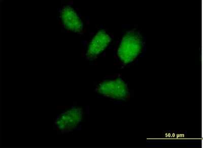 Immunocytochemistry/Immunofluorescence: RNF8 Antibody [H00009025-B01P] - Analysis of purified antibody to RNF8 on HeLa cell. (antibody concentration 10 ug/ml)