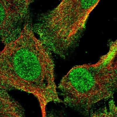 Immunocytochemistry/Immunofluorescence: RNF8 Antibody [NBP2-57378] - Staining of human cell line U-2 OS shows localization to nucleus & cytosol.