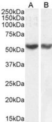 Western Blot: RNF8 Antibody [NB100-1176] - Staining of HepG2 (A) and Jurkat (B) nuclear cell lysate (35 ug protein in RIPA buffer). Antibody at 1 ug/mL. Detected by chemiluminescence.