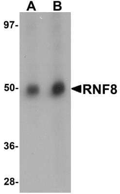 Western Blot: RNF8 Antibody [NBP1-77166] - Human lung tissue lysate with RNF8 antibody at (A) and (B) 2 ug/mL.