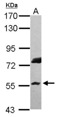 Western Blot: RNF8 Antibody [NBP2-20193] - Sample (30 ug of whole cell lysate) A: HepG2 7. 5% SDS PAGE gel, diluted at 1:5000.