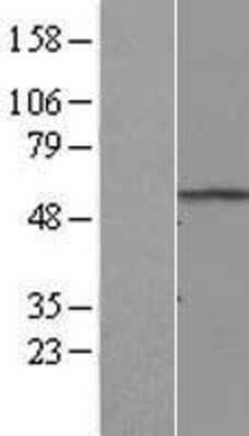 Western Blot: RNF8 Overexpression Lysate (Adult Normal) [NBL1-15460] Left-Empty vector transfected control cell lysate (HEK293 cell lysate); Right -Over-expression Lysate for RNF8.