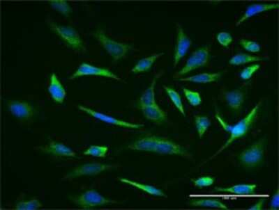 Immunocytochemistry/Immunofluorescence: RNF98 Antibody (1G11) [H00055521-M02] - Analysis of monoclonal antibody to TRIM36 on HeLa cell . Antibody concentration 10 ug/ml.