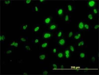 Immunocytochemistry/Immunofluorescence: RNF98 Antibody (2D11) [H00055521-M01] - Analysis of monoclonal antibody to TRIM36 on HeLa cell. Antibody concentration 10 ug/ml.