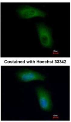 Immunocytochemistry/Immunofluorescence: RNF98 Antibody [NBP1-33644] - Analysis of methanol-fixed A549, using antibody at 1:500 dilution.