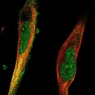 Immunocytochemistry/Immunofluorescence: RNF98 Antibody [NBP2-56200] - Staining of human cell line RH-30 shows localization to nucleus, nuclear bodies & cytosol. Antibody staining is shown in green.