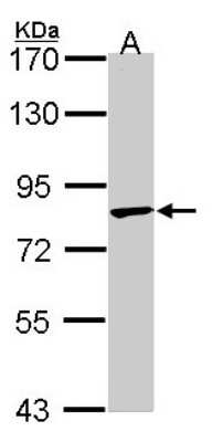 Western Blot: RNF98 Antibody [NBP1-33644] - Sample (30 ug of whole cell lysate) A: A549 7. 5% SDS PAGE; antibody diluted at 1:1000.