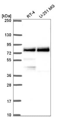 Western Blot: RNF98 Antibody [NBP2-56200] - Analysis in human cell line RT-4 and human cell line U-251 MG.