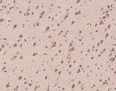 Immunohistochemistry-Paraffin: RNFT2 Antibody [NBP3-06145] - Immunochemical staining of human RNFT2 in human brain with rabbit polyclonal antibody at 1:100 dilution, formalin-fixed paraffin embedded sections.