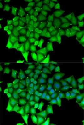 Immunocytochemistry/Immunofluorescence: RNGTT Antibody [NBP2-94014] - Analysis of MCF7 cells using RNGTT . Blue: DAPI for nuclear staining.