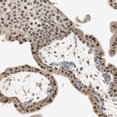 Immunohistochemistry-Paraffin: RNGTT Antibody [NBP1-83281] - Staining of human placenta shows strong nuclear positivity in trophoblastic cells and decidual cells.