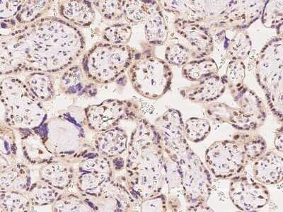 Immunohistochemistry-Paraffin: RNGTT Antibody [NBP2-97837] - Immunochemical staining of human RNGTT in human placenta with rabbit polyclonal antibody at 1:100 dilution, formalin-fixed paraffin embedded sections.