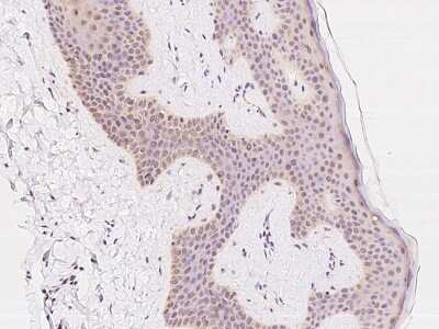 Immunohistochemistry-Paraffin: RNGTT Antibody [NBP2-97837] - Immunochemical staining of human RNGTT in human skin with rabbit polyclonal antibody at 1:100 dilution, formalin-fixed paraffin embedded sections.